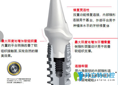 牙齒缺失危害大 咸陽(yáng)小白兔口腔5大牙齒種植體幫你解決