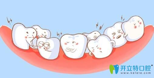 阜陽(yáng)貝得口腔做成人牙齒矯正和兒童牙齒矯正有什么不同？