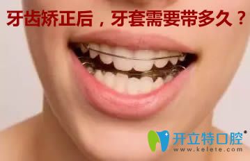 做完牙齒矯正后，保持器需要戴多長(zhǎng)時(shí)間？看完你就明白了