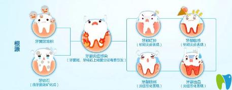 患有牙周病的人平時應(yīng)注意些什么？