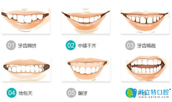 哪些情況牙齒需要矯正？牙齒矯正需要多少時間？