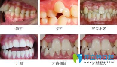 長沙美萊口腔牙齒矯正不設(shè)年齡，讓您洋溢燦爛的笑容
