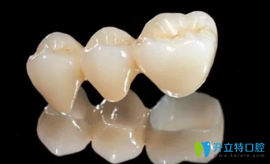 二氧化鋯全瓷牙價(jià)格是多少？深圳汪洋齒科吳健雄揭秘啦