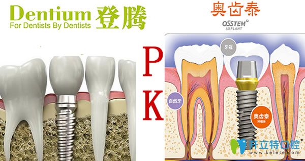 韓國登騰和奧齒泰哪個(gè)更好？兩個(gè)種植體優(yōu)劣對比(2024新版)