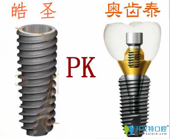 美國皓圣和韓國奧齒泰哪個種植體好？價格及使用壽命大PK
