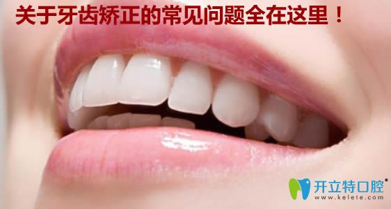 關于小孩牙齒矯正的年齡及其它常見問題的解答都在這