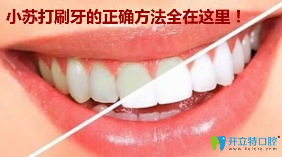 關于小蘇打刷牙的正確方法及刷牙多久能變白的答案都在這