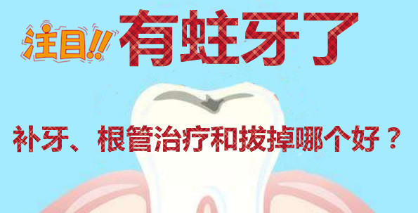 蛀牙怎么辦 補牙根管治療和直接拔掉哪個好 得看齲壞程度