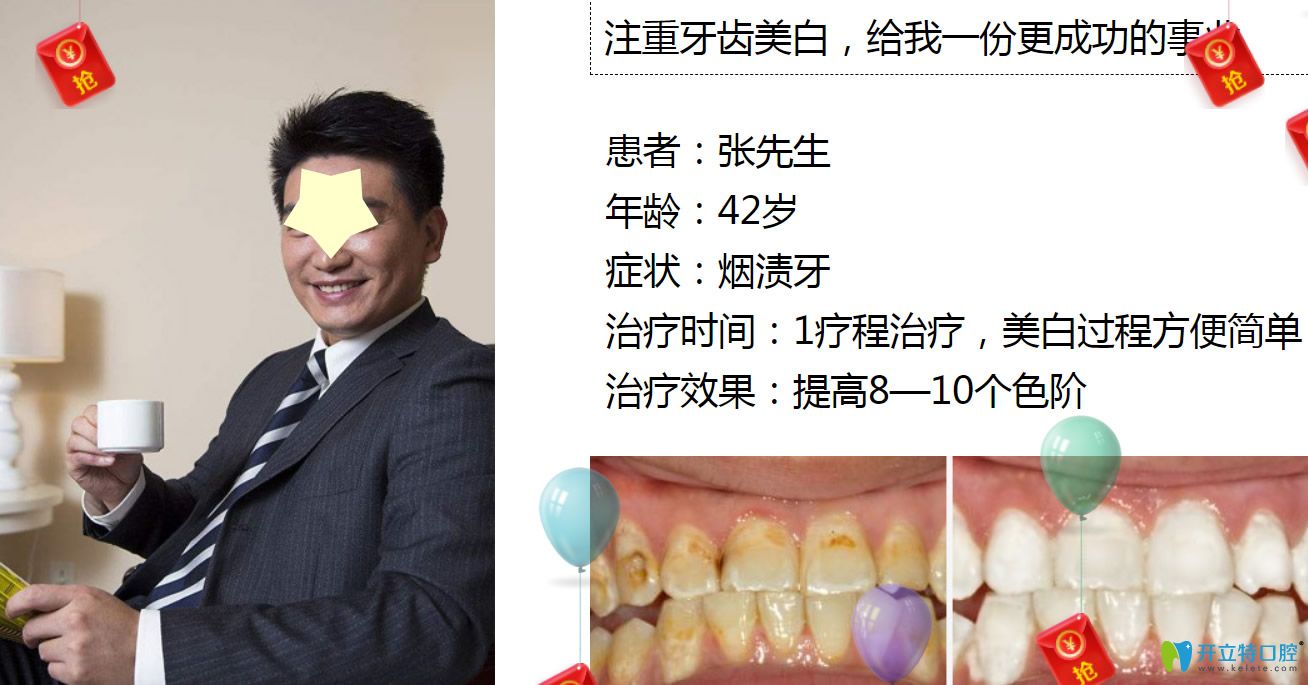 深圳牙齒美白哪里做？格倫菲爾口腔皓齒美白案例公布