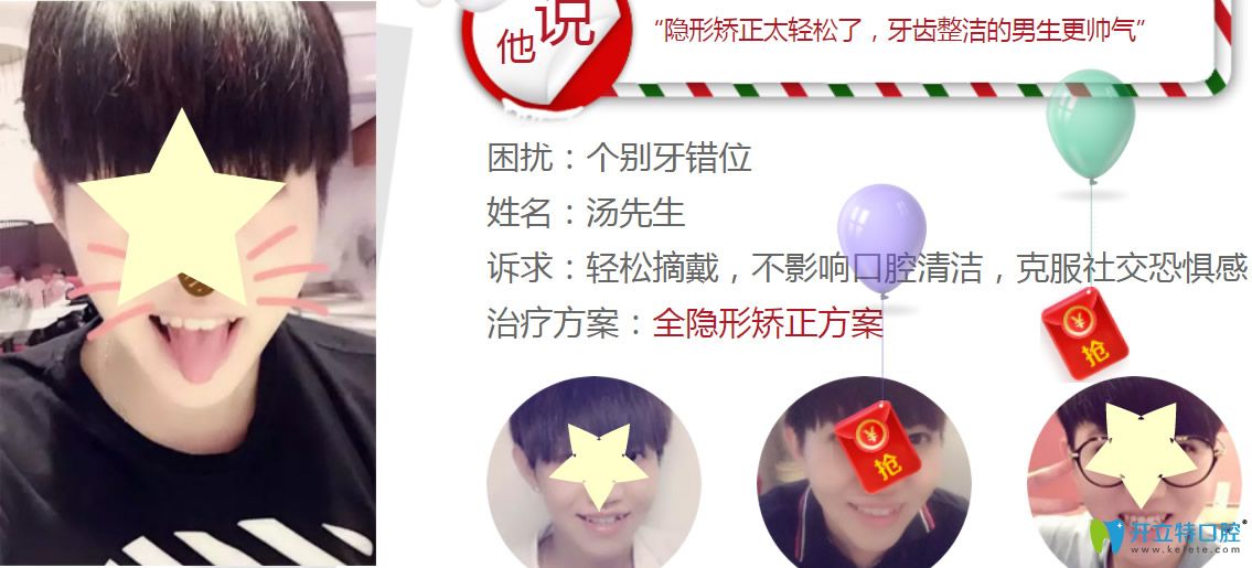 深圳格倫菲爾口腔水平怎么樣？看牙齒正畸真人案例反饋