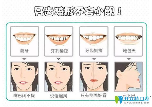 牙友自身看牙經(jīng)歷評測深圳友誠齒科正畸價格及效果怎么樣