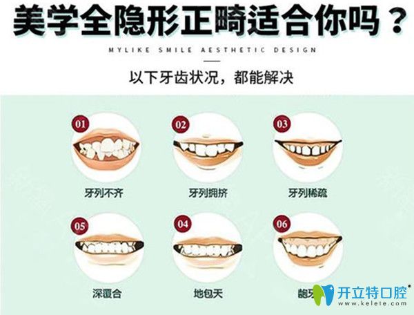 美學矯正適用情況