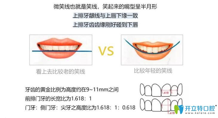 DSD美學(xué)微笑曲線設(shè)計圖