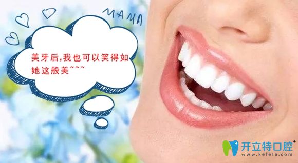 正畸配合美加超薄瓷貼面修復(fù)是我牙齒變美的小秘笈！