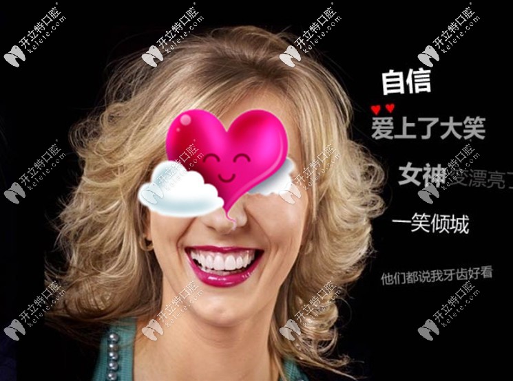 經(jīng)過DSD微笑設(shè)計(jì)后做的瓷貼面后