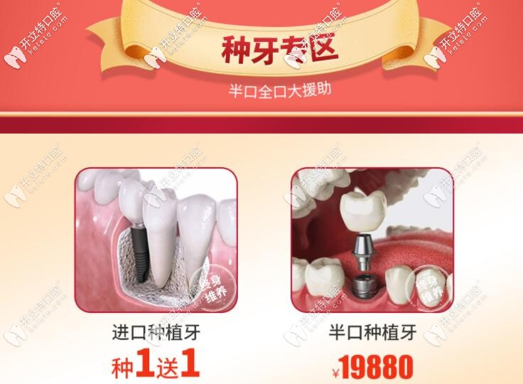 南寧柏樂(lè)口腔種植牙優(yōu)惠價(jià)格