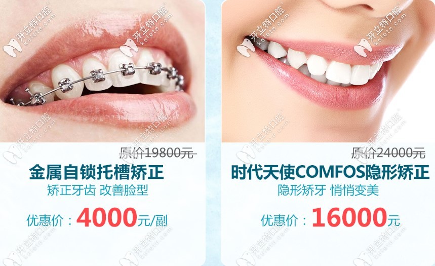 廣州市牙套價格表請收藏,金屬自鎖+隱形矯正的費用值得一觀