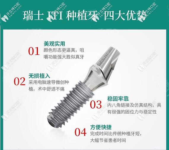 深圳河山口腔門診部瑞士ITI種植牙優(yōu)勢