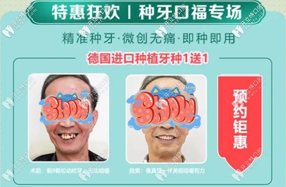 八月廣州廣大口腔的美國進口種植牙5750元就能帶走哦