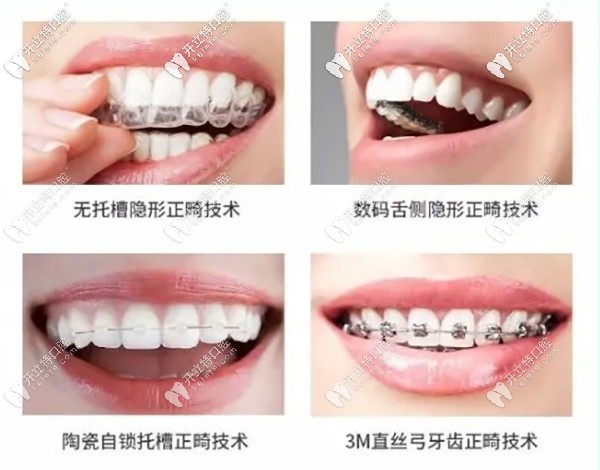 矯正方式