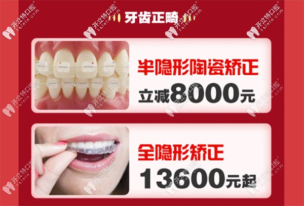 深圳銘德口腔做國(guó)產(chǎn)全隱形矯正價(jià)格13600元起