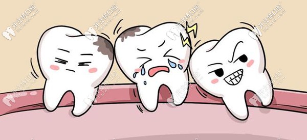 廈門登特口腔拔智齒多少錢？想知道登特和公立醫(yī)院比貴么