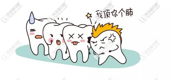 廈門(mén)登特口腔拔復(fù)雜智齒較公辦醫(yī)院稍貴