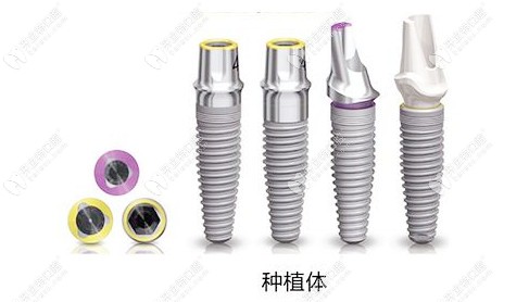分享沈陽盛大口腔價格表，盛大做種植牙口碑好價格還不貴
